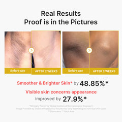 Kojic Acid Turmeric Body Peel Shot